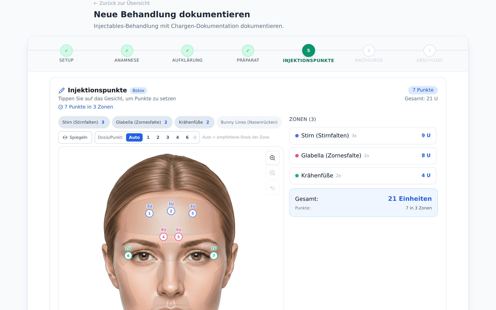 Injektionspunkte-Dokumentation mit Face-Chart – Botox Zonen, Einheiten und Dosierung