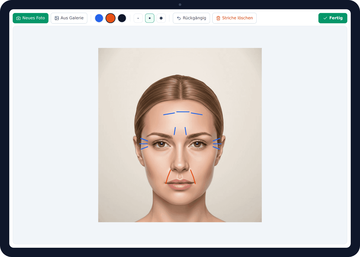 Freihand-Skizze am iPad – Behandlungszonen direkt auf dem Patientenfoto markiert